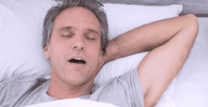Anti-Snoring Device SnoreDoc