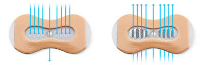 how epap theravent works