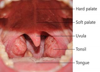 snoring throat