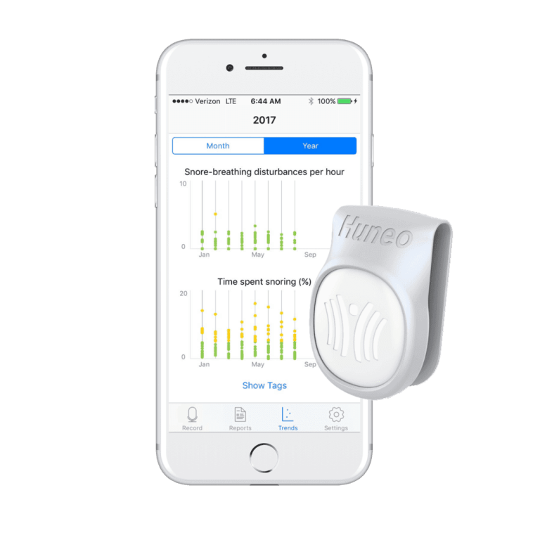 Snorecoach Review – Does the Smart Device Work?