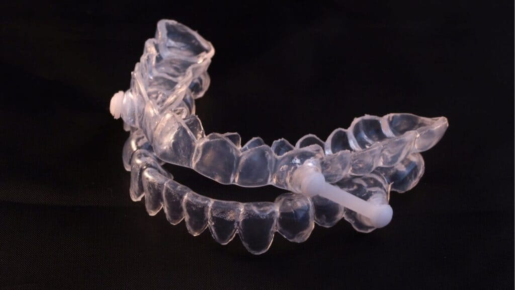 Clear custom mandibular advancement device with upper and lower trays joined by a connecting arm on a black surface